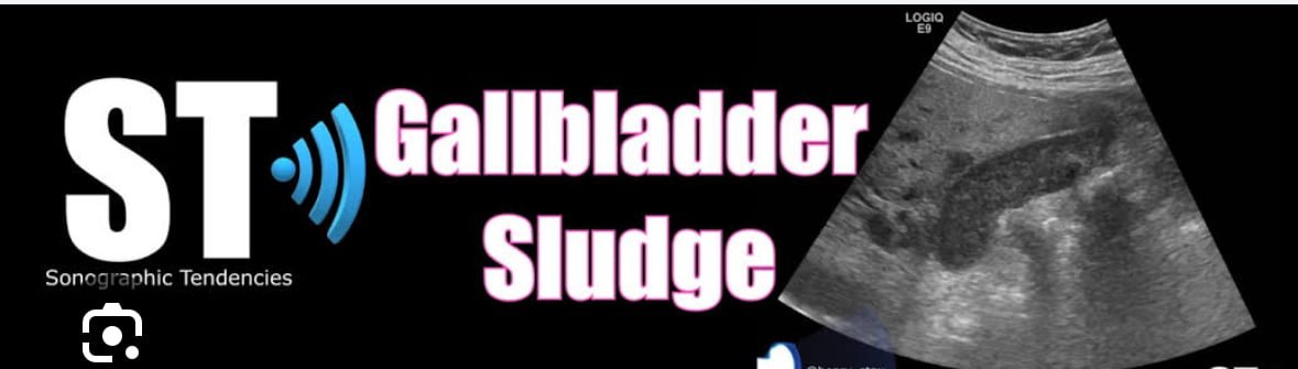 Gallbladder Sludge Vs Gallstones Understanding The Difference Dr