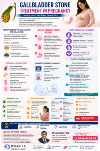 Gallbladder stone treatment during Pregnancy 