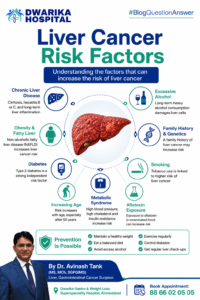Liver Cancer Risk Factors 