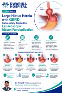 Large Hiatus Hernia with GERD Successfully Treated by Laparoscopic Nissen Fundoplication