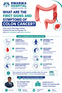 What Are the First Signs and Symptoms of Colon Cancer?