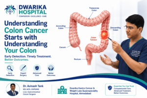 Colon Cancer