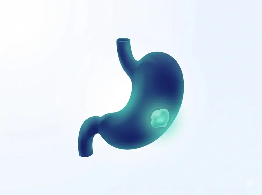 Stomach (Gastric) Cancer