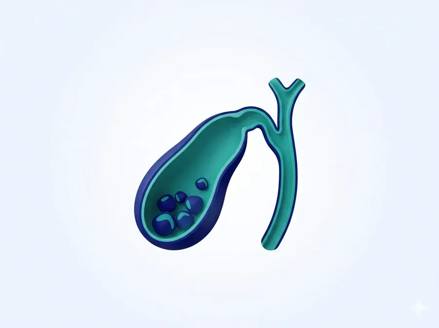 Gallbladder Stones (Gallstones)