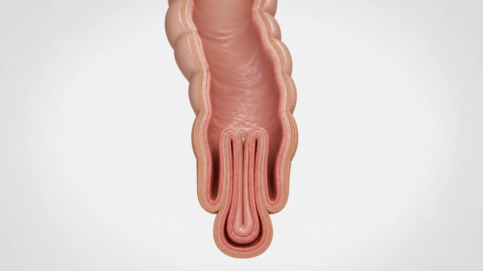 Rectal Prolapse treatment by Dr. Avinash Tank in Ahmedabad