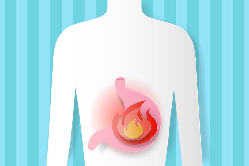 Acidity: Causes, Diagnosis, Treatment and Prevention