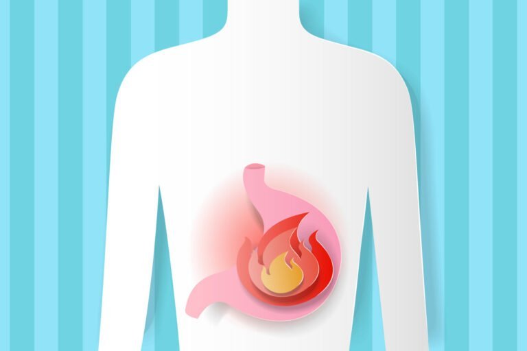 Acidity: Causes, Diagnosis, Treatment and Prevention