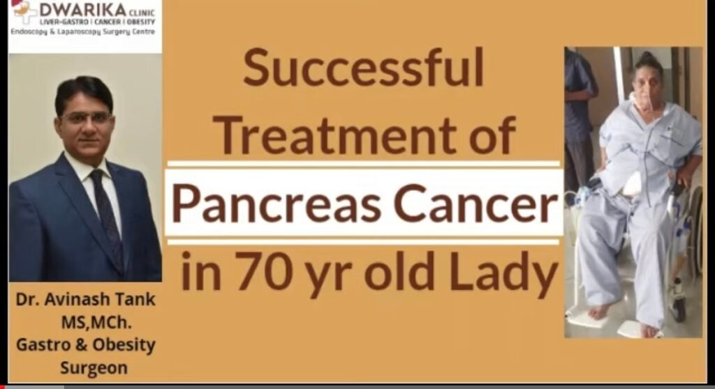 Successful Treatment of Pancreas Cancer in 70-Year-Old Woman at Ahmedabad