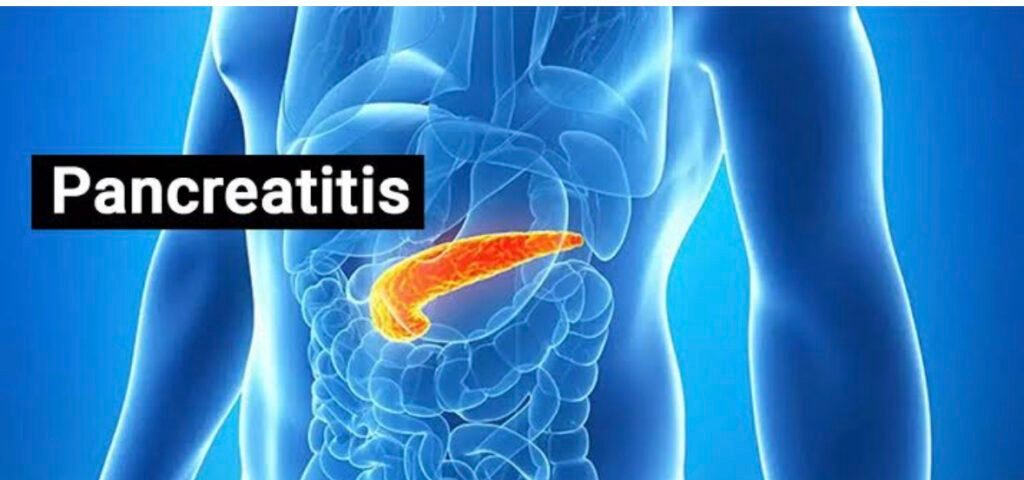Successful 10-Hour Surgery Saves Life of Madhya Pradesh Man Suffering from Chronic Pancreatitis