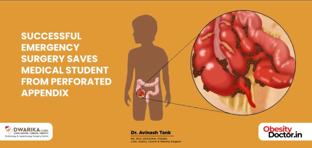 Successful Emergency Surgery Saves Medical Student from Perforated Appendix