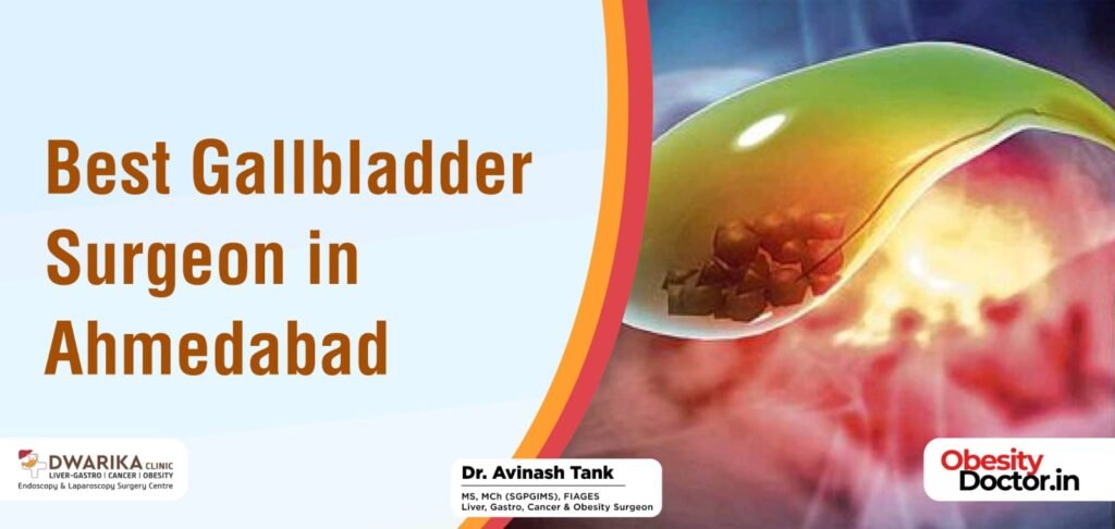 Best Gallbladder Surgeon in Ahmedabad
