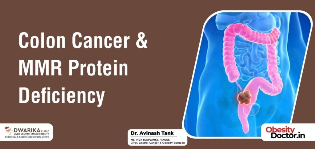 Colon Cancer & MMR Protein Deficiency