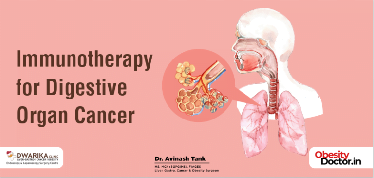 Immunotherapy for Digestive Organ Cancer