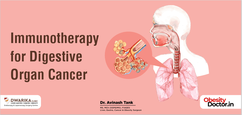 Immunotherapy for Digestive Organ Cancer