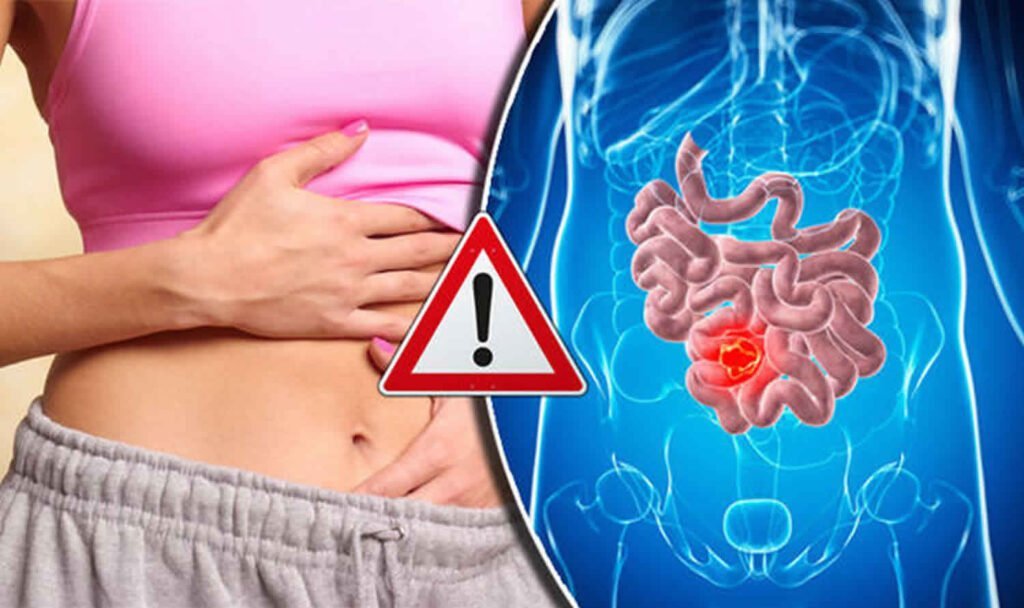 Fecal Impaction Causes and Treatment