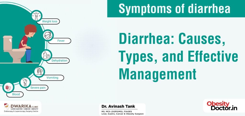 Diarrhea: Causes, Types, and Effective Management