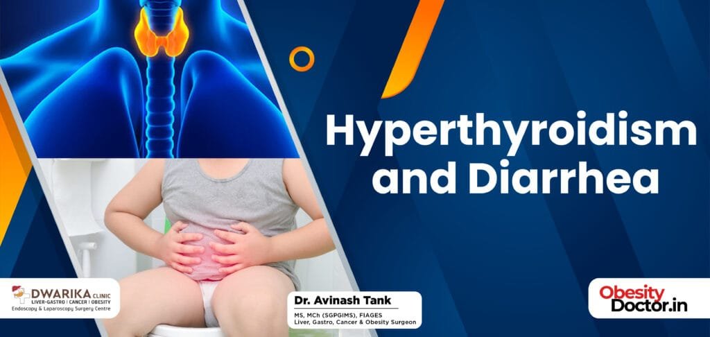 Hyperthyroidism and Diarrhea