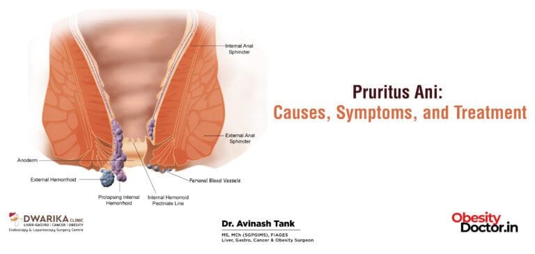 Pruritus Ani: Causes, Symptoms, and Treatment
