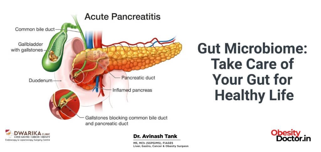 Gut Microbiome: Take Care of Your Gut for Healthy Life