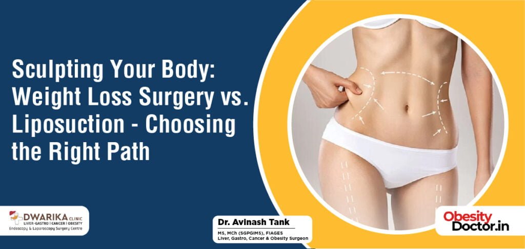 Sculpting Your Body: Weight Loss Surgery vs. Liposuction – Choosing the Right Path