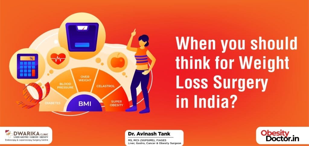 When you should think for Weight Loss Surgery in India?