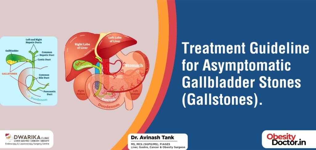 Treatment Guideline for Asymptomatic Gallbladder Stones (Gallstones).