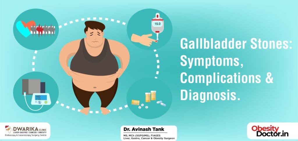 Gallbladder Stones: Symptoms, Complications & Diagnosis.