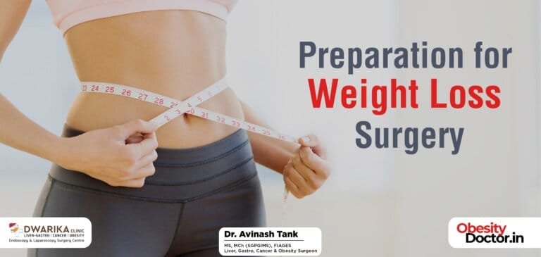 Preparation for Weight Loss Surgery