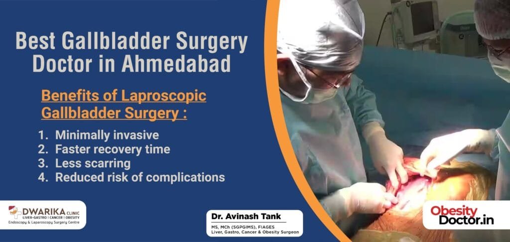 Best Gallbladder Surgery Doctor in Ahmedabad
