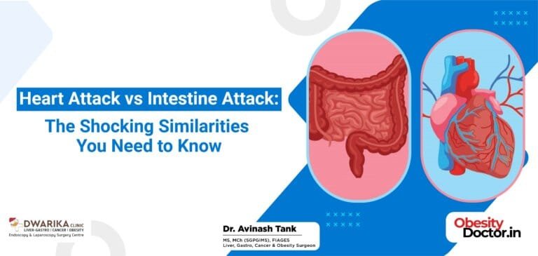 Heart Attack vs. Intestine Attack: The Shocking Similarities You Need to Know
