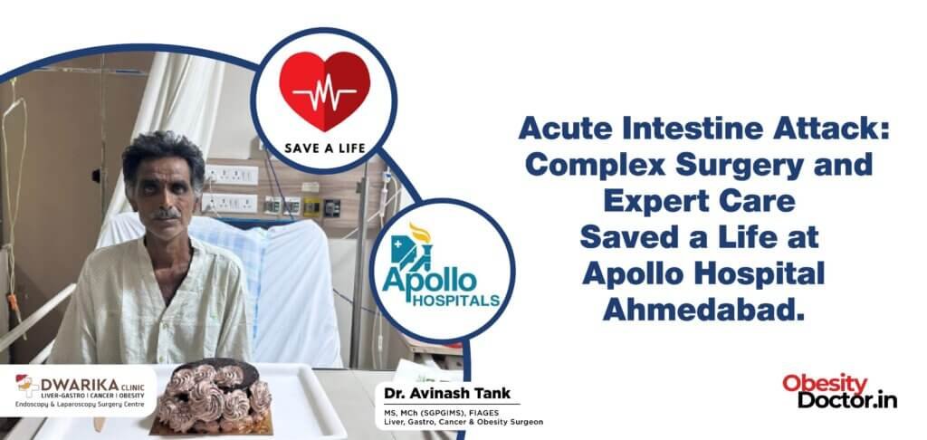 Acute Intestine Attack: Complex Surgery and Expert Care Saved a Life at Apollo Hospital Ahmedabad