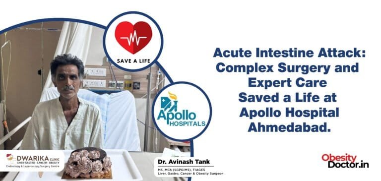 Acute Intestine Attack: Complex Surgery and Expert Care Saved a Life at Apollo Hospital Ahmedabad