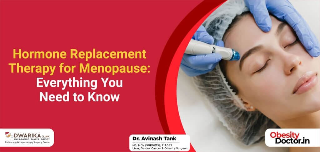 Hormone Replacement Therapy for Menopause: Everything You Need to Know