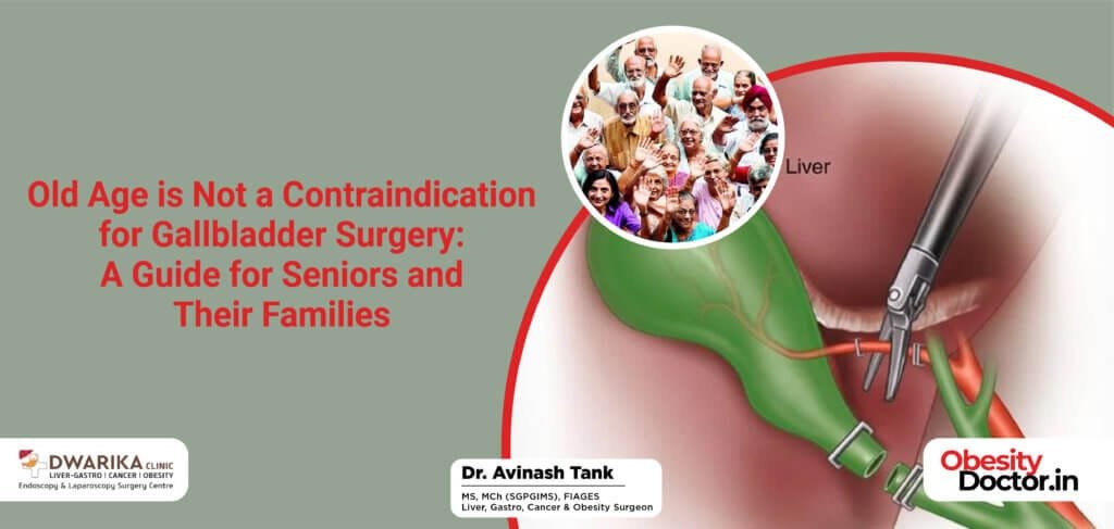 Old Age is Not a Contraindication for Gallbladder Surgery: A Guide for Seniors and Their Families