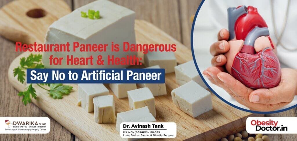 Restaurant Paneer is Dangerous for Heart & Health: Say No to Artificial Paneer