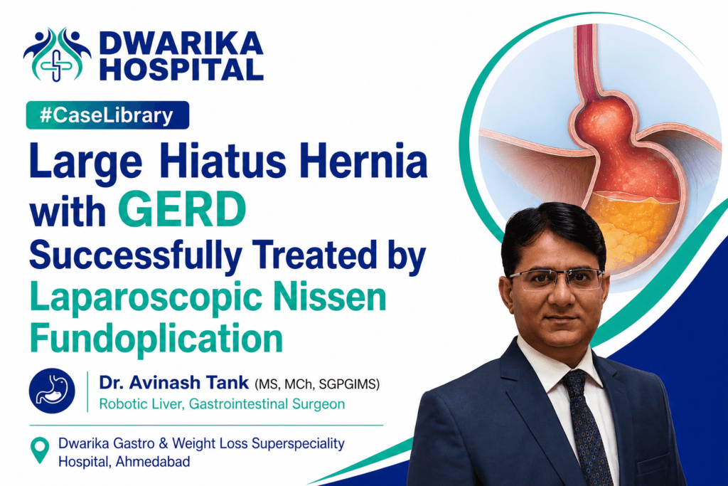 Large Hiatus Hernia with GERD Successfully Treated by Laparoscopic Nissen Fundoplicatio