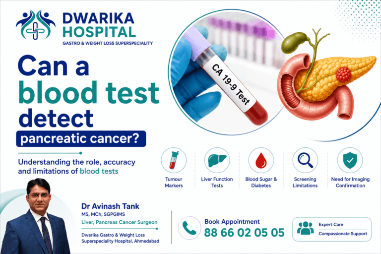 Can Pancreatic Cancer Be Detected in Blood Tests?
