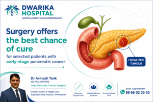 “Surgery offers the best chance of cure for selected patients with early-stage pancreatic cancer.”
