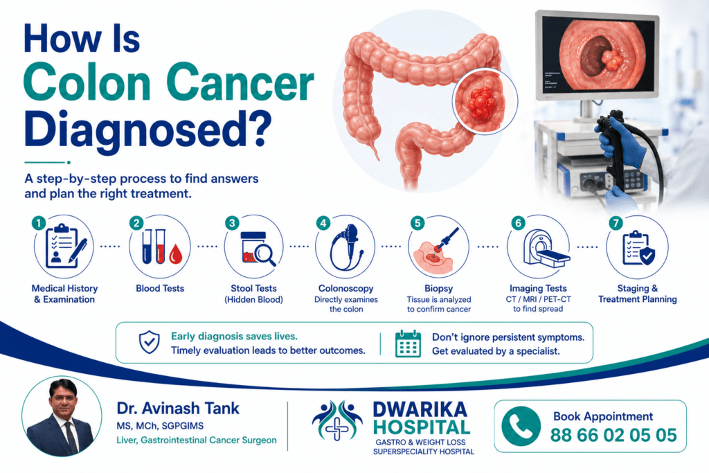 How Is Colon Cancer Diagnosed?
