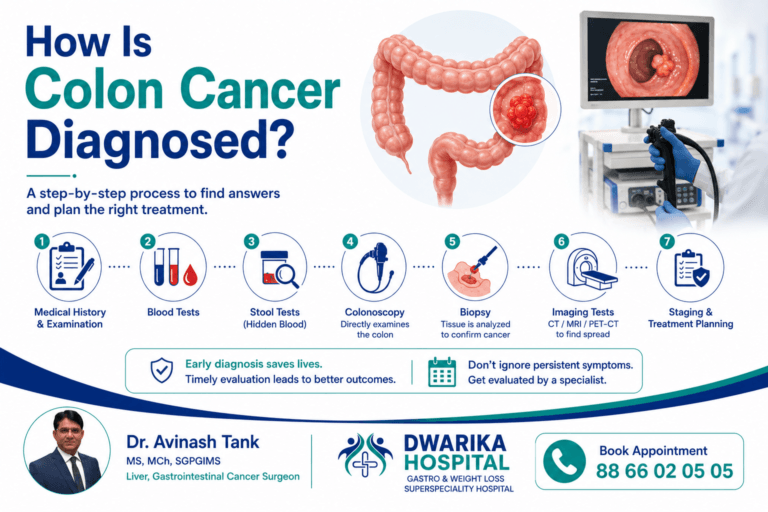 How Is Colon Cancer Diagnosed?