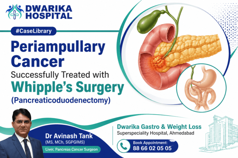 Periampullary Cancer Successfully Treated with Whipple’s Surgery (Pancreaticoduodenectomy)