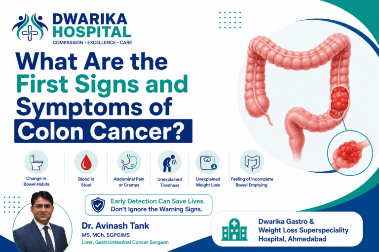 What Are the First Signs and Symptoms of Colon Cancer?