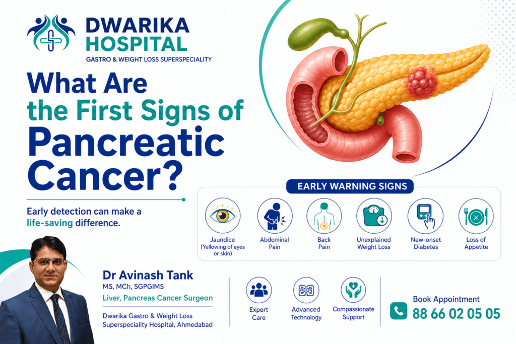 What Are the First Signs of Pancreatic Cancer?