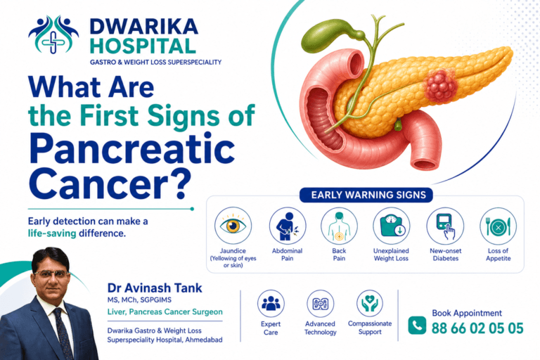 What Are the First Signs of Pancreatic Cancer?