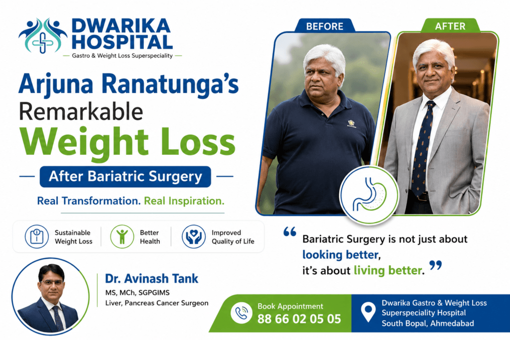 Arjuna Ranatunga’s Remarkable Weight Loss After Bariatric Surgery
