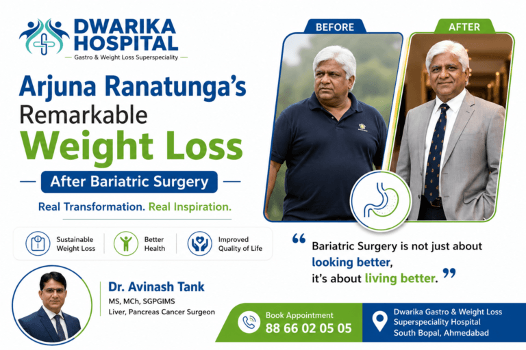 Arjuna Ranatunga’s Remarkable Weight Loss After Bariatric Surgery