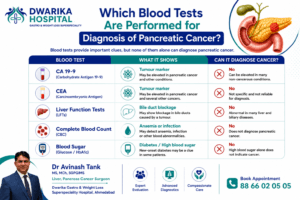 Which Blood Tests Are Performed for diagnosis of Pancreas Cancer