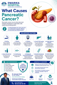 What Causes Pancreatic Cancer? 
