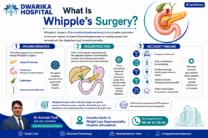 What Is Whipple’s Surgery?