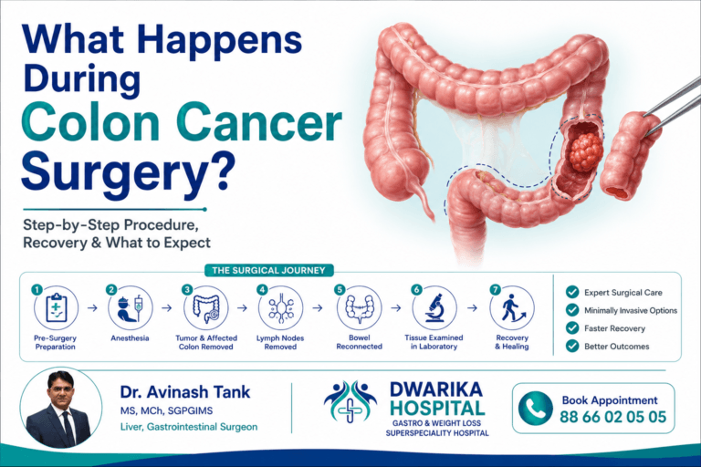 What Happens During Colon Cancer Surgery?